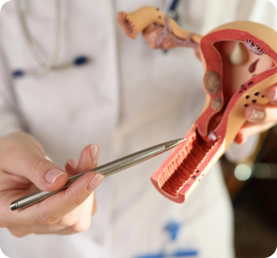 Fibroids Solutions