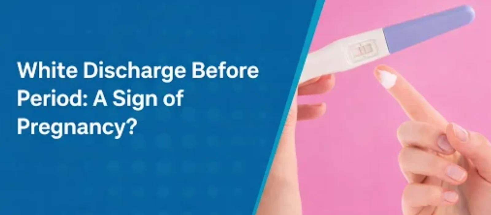 White Discharge Before Period a Sign of Pregnancy