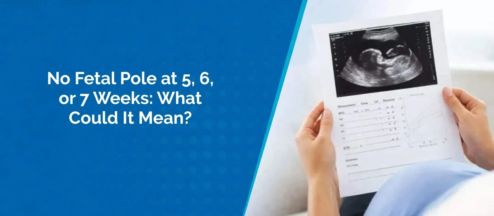 No Fetal Pole at 5, 6, or 7 Weeks: What Could It Mean?