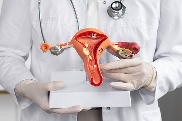 Unveiling Endometriosis Understanding Symptoms