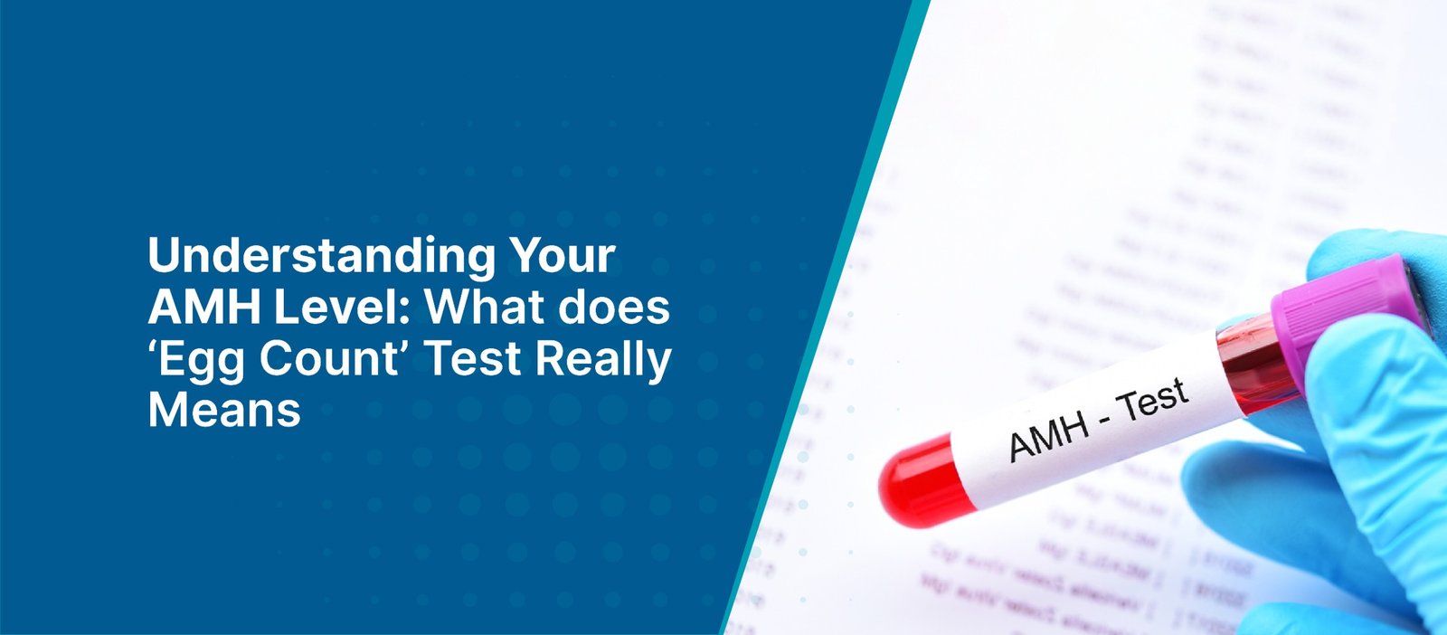 Understanding Your AMH Level: What does ‘Egg Count’ Test Really Means