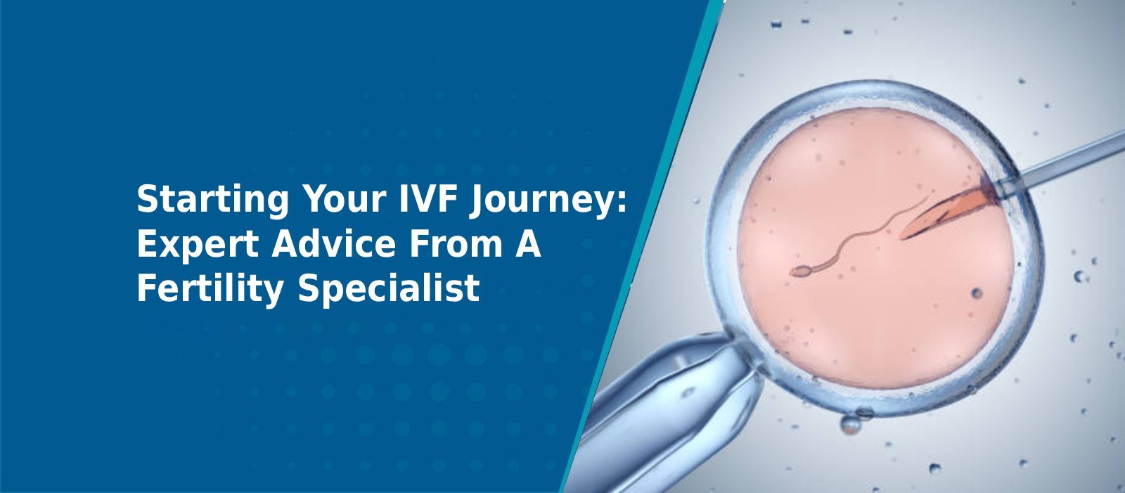 Starting Your IVF Journey: Expert Advice From A Fertility Specialist