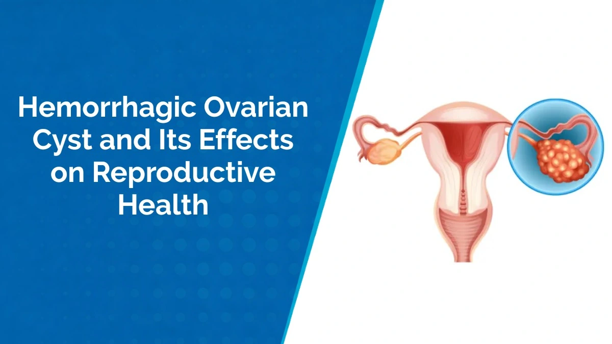 hemorrhagic-ovarian-cyst-effects-reproductive-health